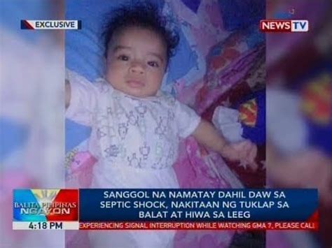 tuklap na balat in english